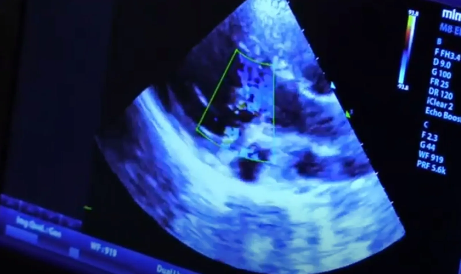A view of an ultrasound screen at Brookswood Animal Clinic